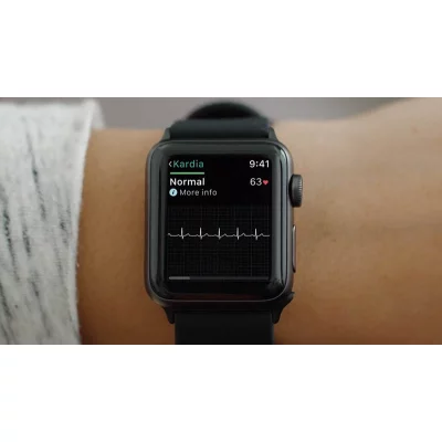 ЕКГ на Apple Watch